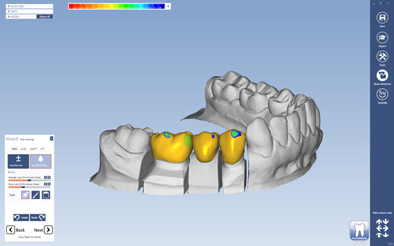 Planmeca CAD/CAM Lab